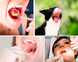Apensar dentista gato